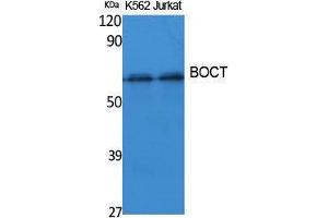 Western Blotting (WB) image for anti-Solute Carrier Family 22 (Organic Cation Transporter), Member 17 (SLC22A17) (Internal Region) antibody (ABIN3187626)