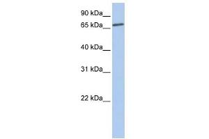 LSS antibody used at 1 ug/ml to detect target protein. (LSS 抗体)