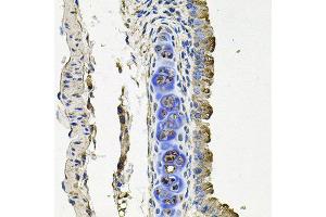 Immunohistochemistry of paraffin-embedded mouse lung using FLT1 antibody at dilution of 1:100 (x40 lens). (FLT1 抗体)
