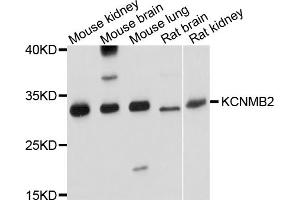 Western blot analysis of extracts of various cell lines, using KCNMB2 antibody. (KCNMB2 抗体)