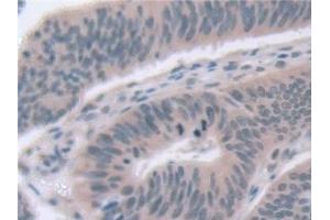 Immunohistochemistry (IHC) image for anti-Exosome Component 2 (EXOSC2) (AA 1-293) antibody (ABIN7441514)