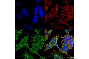 Immunocytochemistry/Immunofluorescence analysis using Mouse Anti-GluN2A/NR2A Monoclonal Antibody, Clone S327-95 . (NMDAR2A 抗体  (AA 75-325) (Atto 488))