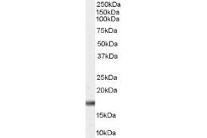 Image no. 1 for anti-Peptidylprolyl Cis/trans Isomerase, NIMA-Interacting 1 (PIN1) (Internal Region) antibody (ABIN374746) (PIN1 抗体  (Internal Region))