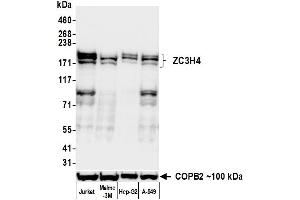 Western Blotting (WB) image for anti-Zinc Finger CCCH-Type Containing 4 (ZC3H4) (AA 1050-1100) antibody (ABIN7795759)