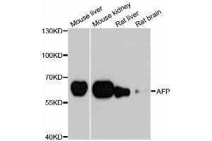Western blot analysis of extracts of various cell lines, using AFP antibody. (alpha Fetoprotein 抗体)