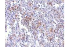 Immunohistochemistry of EVER1 in human spleen with EVER1 antibody at 2. (TMC6 抗体  (Center))