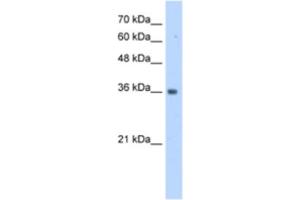 Western Blotting (WB) image for anti-TruB Pseudouridine (Psi) Synthase Homolog 2 (TRUB2) antibody (ABIN2463175) (TRUB2 抗体)