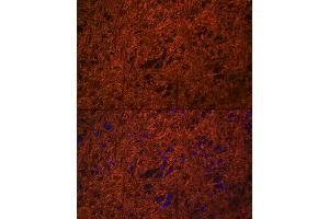 Immunofluorescence analysis of mouse brain using SN Rabbit pAb (ABIN3021231, ABIN3021232, ABIN3021233 and ABIN6214078) at dilution of 1:100 (40x lens). (SNAP25 抗体  (AA 1-206))