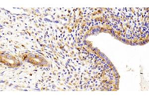 Detection of Kim1 in Rat Uterus Tissue using Polyclonal Antibody to Kidney Injury Molecule 1 (Kim1) (HAVCR1 抗体  (AA 22-235))