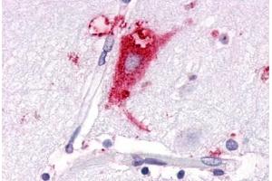 Anti-GPR63 antibody  ABIN1048855 IHC staining of human brain, neurons and glia. (GPR63 抗体  (C-Term))