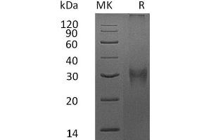 Western Blotting (WB) image for Fibrillin 1 (FBN1) protein (His tag) (ABIN7320523) (Fibrillin 1 Protein (FBN1) (His tag))