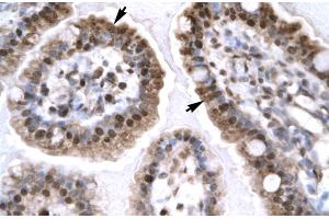 Rabbit Anti-EGR1 Antibody Catalog Number: ARP32241 Paraffin Embedded Tissue: Human Intestine Cellular Data: Epithelial cells of intestinal villas Antibody Concentration: 4.