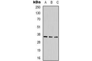 Western blot analysis of CABP2 expression in 293T (A), mouse brain (B), rat brain (C) whole cell lysates. (CABP2 抗体)
