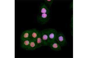 Immunofluorescence (IF) image for anti-Ataxia Telangiectasia Mutated (ATM) (phosphorylated) antibody (ABIN2666314) (ATM 抗体  (phosphorylated))
