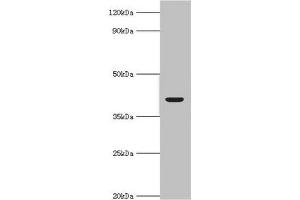 Western blot All lanes: Alcohol dehydrogenase 4 antibody at 2 μg/mL + Mouse liver tissue Secondary Goat polyclonal to rabbit IgG at 1/10000 dilution Predicted band size: 41, 43 kDa Observed band size: 41 kDa (ADH4 抗体  (AA 1-380))