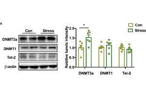 Effect of PS on DNMT and demethylase in adolescence. (TET2 抗体  (AA 1833-2002))