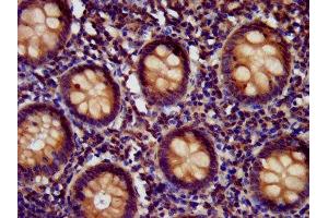 IHC image of ABIN7151786 diluted at 1:400 and staining in paraffin-embedded human appendix tissue performed on a Leica BondTM system. (EDC4 抗体  (AA 753-952))