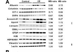 Western Blotting (WB) image for anti-Heat Shock Protein 90kDa alpha (Cytosolic), Class B Member 1 (HSP90AB1) (AA 1-300) antibody (ABIN3021406)