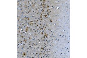 IHC analysis of LSM7 using anti-LSM7 antibody (ABIN7598937). (LSM7 抗体  (AA 1-103))