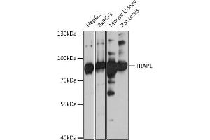 Western blot analysis of extracts of various cell lines, using TR antibody (ABIN1683134, ABIN5664756, ABIN5664758 and ABIN6220605) at 1:3000 dilution. (TRAP1 抗体  (AA 445-704))