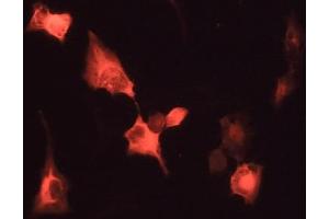 Immunofluorescence - anti-Venus Ab in 293HEK Cells with Venus Protein at 1/50 dilution, Cells were fixed With 4% of PFA (GFP 抗体)