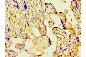 Immunohistochemistry (IHC) image for anti-Pyruvate Dehydrogenase Complex, Component X (PDHX) (AA 1-300) antibody (ABIN7166903)