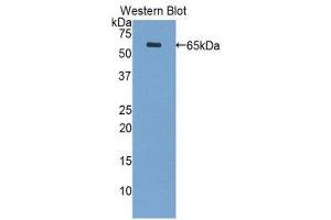 Western Blotting (WB) image for anti-Periplakin (PPL) (AA 1439-1716) antibody (ABIN1860293) (PPL 抗体  (AA 1439-1716))