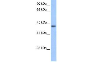 Transfected 293T; WB Suggested Anti-NEUROD6 Antibody Titration: 0. (NEUROD6 抗体  (Middle Region))