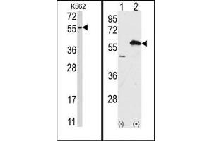 Image no. 1 for anti-Ubiquilin 1 (UBQLN1) (Middle Region) antibody (ABIN357612) (Ubiquilin 1 抗体  (Middle Region))