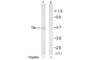 Image no. 1 for anti-Microtubule-Associated Protein tau (MAPT) (Ser235) antibody (ABIN197261) (MAPT 抗体  (Ser235))