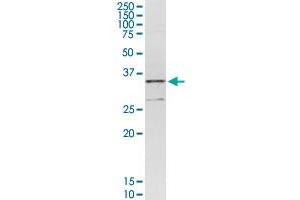 CENPH MaxPab rabbit polyclonal antibody. (CENPH 抗体  (AA 1-247))