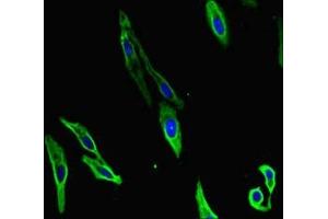 Immunofluorescent analysis of Hela cells using ABIN7155449 at dilution of 1:100 and Alexa Fluor 488-congugated AffiniPure Goat Anti-Rabbit IgG(H+L) (CARM1 抗体  (AA 209-379))