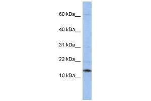 WB Suggested Anti-SNRPD2 Antibody Titration:  0. (SNRPD2 抗体  (Middle Region))