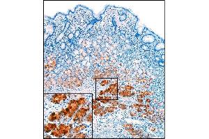 Immunohistochemistry (IHC) image for anti-Pepsinogen A antibody (ABIN108409) (Pepsinogen A 抗体)