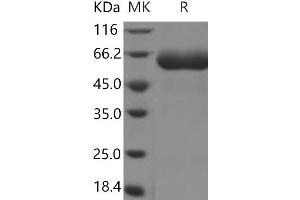 Western Blotting (WB) image for Interleukin 22 Receptor, alpha 1 (IL22RA1) protein (Fc Tag,ECD) (ABIN7196511)