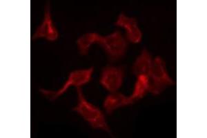 Immunofluorescence (fixed cells) (IF/ICC) image for anti-Solute Carrier Family 30 (Zinc Transporter), Member 1 (SLC30A1) (Internal Region) antibody (ABIN6259190)
