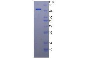SDS-PAGE analysis of Chicken Interferon alpha Protein. (IFNA 蛋白)