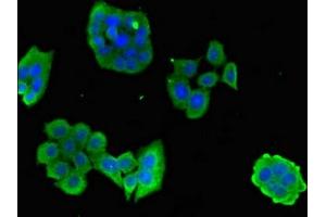 Immunofluorescent analysis of PC-3 cells using ABIN7146768 at dilution of 1:100 and Alexa Fluor 488-congugated AffiniPure Goat Anti-Rabbit IgG(H+L) (CPB2 抗体  (AA 225-372))