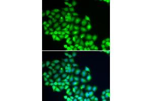 Immunofluorescence analysis of HeLa cells using XPD/XPD/ERCC2 antibody (ABIN6130301, ABIN6140265, ABIN6140266 and ABIN6221277). (ERCC2 抗体  (AA 1-300))