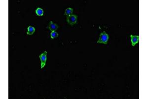 Immunofluorescent analysis of HepG2 cells using ABIN7171786 at dilution of 1:100 and Alexa Fluor 488-congugated AffiniPure Goat Anti-Rabbit IgG(H+L) (FAM46C 抗体  (AA 1-391))
