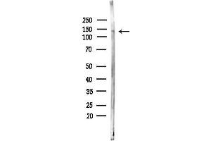 anti-SCL/TAL1 Interrupting Locus (STIL) (C-Term) antibody