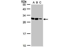 WB Image Sample(30 ug whole cell lysate) A:HeLa S3, B:Hep G2 , C:MOLT4 , 12% SDS PAGE antibody diluted at 1:1000 (ASB9 抗体)