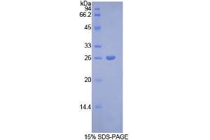 SDS-PAGE analysis of Rat Connexin 43 Protein. (Connexin 43/GJA1 蛋白)