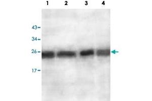 Western blot analysis of ES2 cell (Lane 1), EC109 cell (Lane 2), human fetal lung (Lane 3) and human fetal brain (Lane 4) lysate with AKR1A1 polyclonal antibody  at 1 : 500 dilution. (AKR1A1 抗体  (AA 132-310))