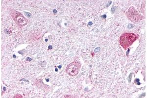 Anti-NR1D1 antibody  ABIN1049129 IHC staining of human brain, thalamus. (NR1D1 抗体  (Internal Region))