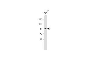 Anti-INB Antibody (C-term) at 1:1000 dilution + Daudi whole cell lysate Lysates/proteins at 20 μg per lane. (INPP5B 抗体  (C-Term))