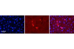 Rabbit Anti-MAPK7 Antibody  Catalog Number: ARP57731_P050 Formalin Fixed Paraffin Embedded Tissue: Human Adult Liver  Observed Staining: Cytoplasm in Kupffer cells only, strong signal, low tissue distribution Primary Antibody Concentration: 1:100 Secondary Antibody: Donkey anti-Rabbit-Cy3 Secondary Antibody Concentration: 1:200 Magnification: 20X Exposure Time: 0. (MAPK7 抗体  (Middle Region))