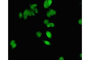 Immunofluorescent analysis of HepG2 cells using ABIN7154802 at dilution of 1:100 and Alexa Fluor 488-congugated AffiniPure Goat Anti-Rabbit IgG(H+L) (NHP2 抗体  (AA 1-153))