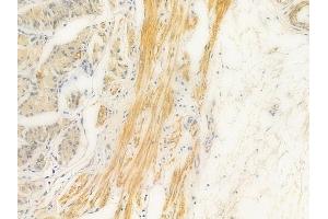 ABIN6261634 and ABIN6269150 at 1/100 staining human normal gastric tissue by IHC-P. (Ezrin 抗体  (C-Term))