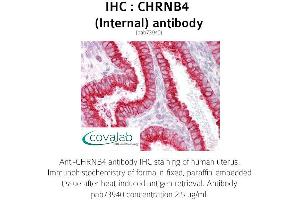 Image no. 1 for anti-Cholinergic Receptor, Nicotinic, beta 4 (Neuronal) (CHRNB4) (Internal Region) antibody (ABIN1733076) (CHRNB4 抗体  (Internal Region))